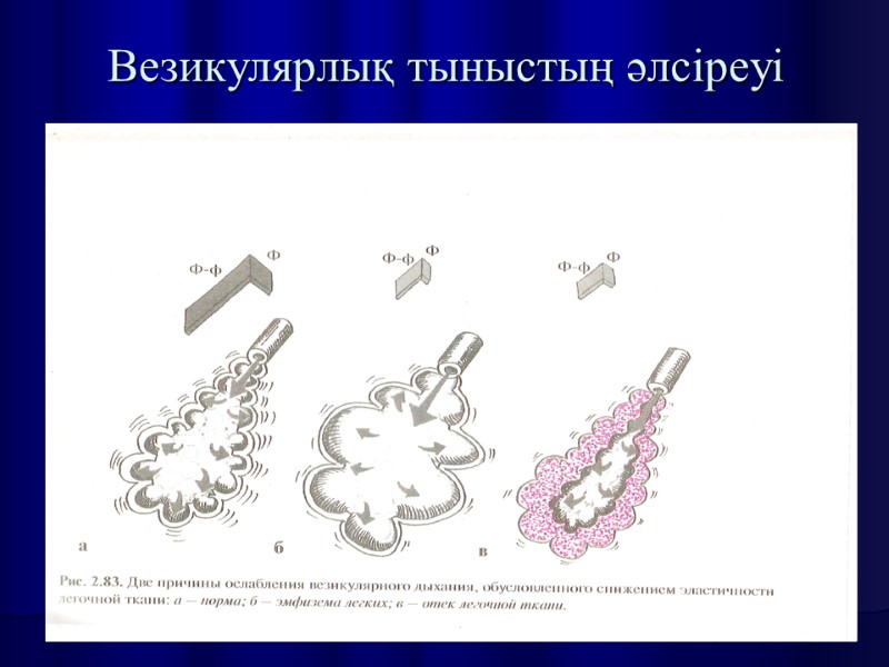 Везикулярлық тыныстың әлсіреуі
